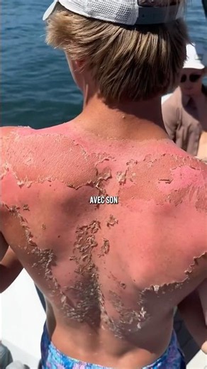 👹 Quand c’est la canicule…