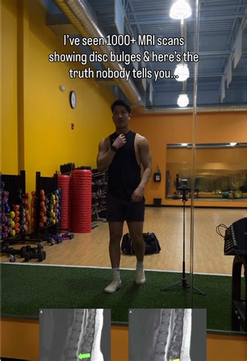 I’ve seen 1000 MRI scans showing disc bulges. Here’s the truth nobody tells you. Your pain isn’t from a weak core or tight hamstrings. All the lumbar rolls, standing desks, treadmill desks, ergonomic chairs, creams, and heating pads? They only get you so far. They are just coping strategies that don’t fix the real problem. If you’re a WFH professional sitting for hours, walking breaks, standing at your desk, or trying to train and your back still flares up, this is why. Your spine isn’t weak. It