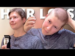 FEMALE PATTERN BALDNESS - MY FULL STORY