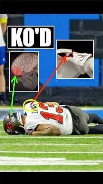 Doctor explains Mike Evans broken collarbone+knock out #fantasyfootball #injury #education #nflnews