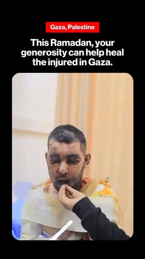 Your generosity can help heal the injured in Gaza🤲🏻 In Gaza, many are still recovering from ongoing hardship and crisis. Access to proper care and basic necessities remains a challenge for countless families. If you would like to support, visit matwproject.org This post is shared for awareness purposes only. #Gaza #Awareness #Ramadan2026 #StandWithGaza #matw | MATW Project