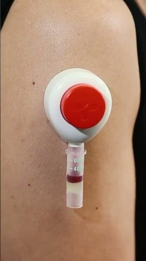 5-Minute Blood Collection — Full Walkthrough