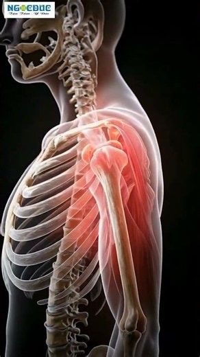 Điều Trị Viêm Chu Vi Khớp Vai Thế Nào Cho Hiệu Quả?
