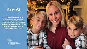 December's International TTTS Awareness Month Fact#2 Lisa and her twins Maurice and Peter New Jersey, USA The later an embryo splits, the more likely complications like TTTS, will occur. Twin to twin transfusion syndrome (TTTS) is a disease of the placenta that affects identical twin pregnancies (or higher gestations) who share a placenta (monochorionic). The shared placenta contains abnormal blood vessels which connects the umbilical cord and circulation of the twins. The events in pregnancy th