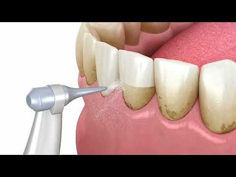 Airflow Hygiene Therapy