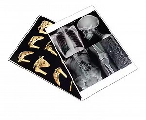 [Hot Item] Premium Medical White Laser Imaging Dry Film for Professionals