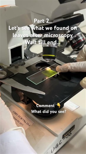 Part 2 of isolating chloroplast. But what is this? #ytshorts #microscope