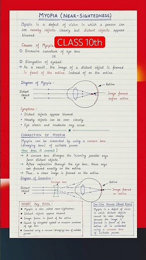 Myopia (Nearsightedness) Explained | Class 10 Science | CBSE Board Exam