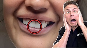 Dentist Explains: Should You SPIT or RINSE After Brushing? 😮🦷 #teeth #brush #dentist | TheBentistofficial