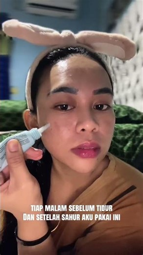 Ampuh untuk mengatasi bekas jerawat kehitaman dan Flek Hitam✨ #acnefighter #acne #skincare #jerawat