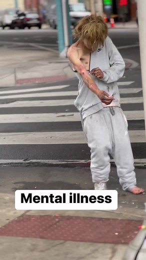 1M views · 3.2K reactions | Kensington Philadelphia Mental Illness #addiction #recovery mentalhealth# #addictionrecovery #love #sober #sobriety #soberlife #recoveryispossible #depression #anxiety #mentalhealthawareness #wedorecover #alcoholism #motivation #soberliving #drugs #drugaddiction #addictionawareness #addict #onedayatatime #aa #alcoholicsanonymous #rehab #life #addicted #selfcare #soberaf #healing #health | AML | Facebook