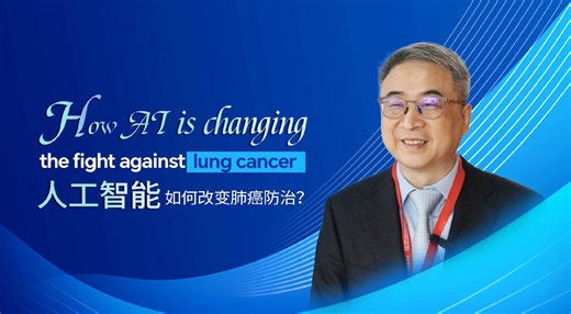 Expert: AI technology a boon for lung cancer detection
