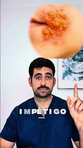 🔎 ¿Esta lesión en la piel es contagiosa o no? Muchas enfermedades de la piel generan dudas