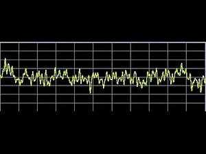 Vision Disorders - Rife Frequencies