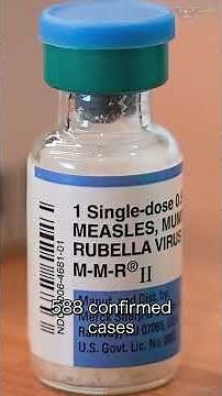ICE facility in Texas struggles with measles outbreak