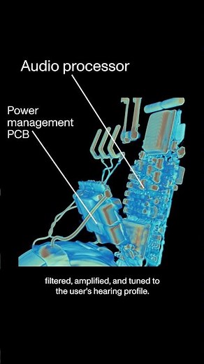 What's inside a hearing aid? CT scans of a Jabra hearing aid