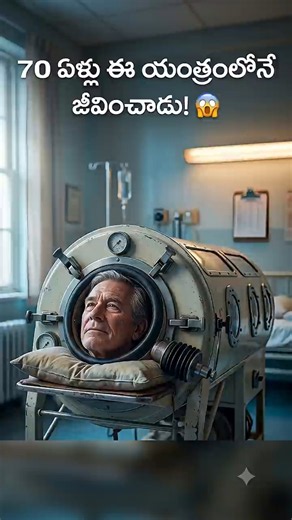 The Man Who Lived Inside an Iron Lung 😳🫁 #facts #youtubeshorts #viralfacts