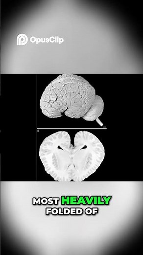 Orca Brain Most Empathetic Animal Astonishing Facts!