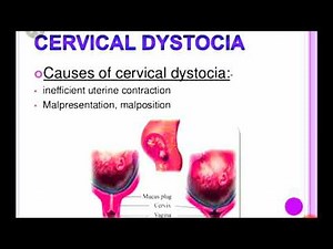 Cervical dystocia