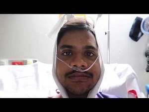 SAME Surgery - Surgically Assisted Maxillary Expansion - 12 Hours After Surgery