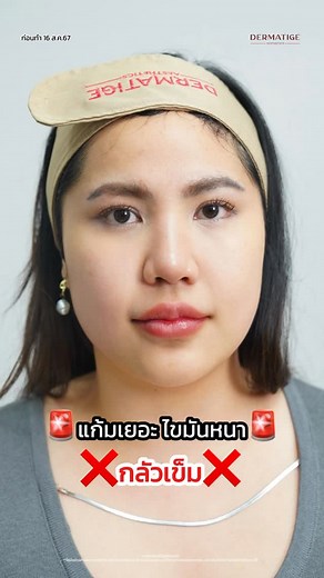 Dermatige Aesthetics on Instagram: "แก้มเยอะ ไขมันหนาเตอะ ต้องลอง🚨ดูโอ้ลดเเก้มเหนียง PROGRAM VOLFORMER X 📍ที่เดอร์มาทีจ สลายไขมันแบบไร้เข็มด้วยโปรแกรมนี้‼️ VolformerX เทคนิคเกาหลีจึ้งๆเล้ยยย💗 💗Program Volnewmer 💙Program Ultraformer MPT 🧑🏻‍⚕️ทีมแพทย์เดอร์มาทีจบินลัดฟ้าถึงเกาหลีเพื่อค้นคว้าเทคนิคนี้ให้ถึงมือค้นไข้แบบเร็วที่สุด ✅ เห็นผลดีขึ้น ✅ หน้าเรียวขึ้น ✅เจ็บน้อยลง ✅สวยมุกมิติขึ้น #ที่แรกๆในประเทศไทย อยากสวยให้ครบทุกมิติ ด้วยเทคนิค Volformer X ต้องมาที่เดอร์มาทีจเท่านั้น จองคิวเลยที่ ht