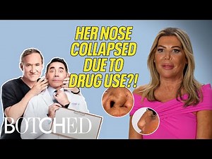British Demi Moore Was A 365 Party Girl and It DESTROYED Her Nose?! (Before & After) | Botched | E!