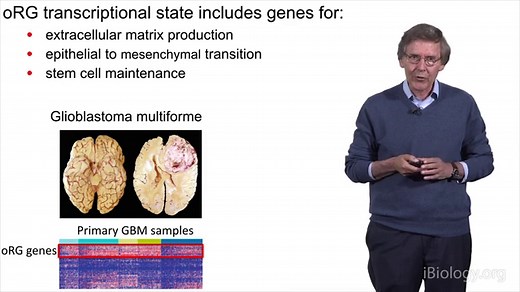 Brain Development: Discovery and Characterization of Outer Subventricular Zone Radial Glia Cells • iBiology