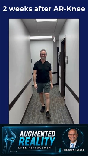 Michael at 2 weeks | Augmented Reality Knee Replacement | Dr. Kassab | OSOC