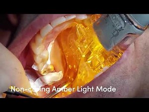 Zyris Isolite® Dental Isolation System