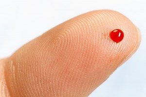 Is it possible to be allergic to your own blood?