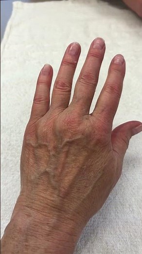 Paraffin Wax Treatment