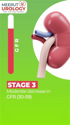 Chronic Kidney Disease (CKD)