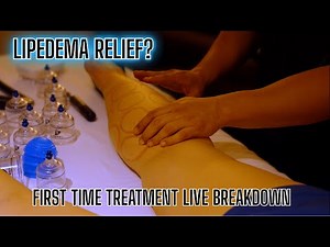 Lipedema Relief? | First-Time Treatment Live Breakdown