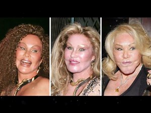 WHO IS JOCELYN WILDENSTEIN? CAUSE OF DEATH, AGE, HUSBAND, SURGERIES AND NET WORTH