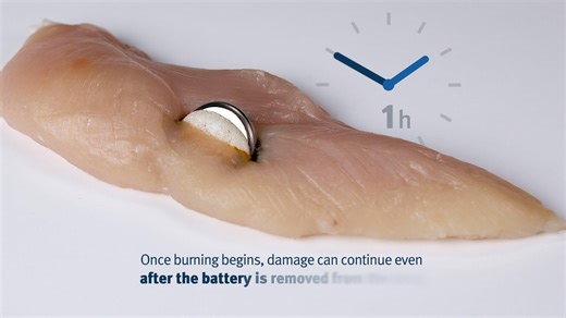 If you're a parent or carer, put button batteries on your radar. 🚨 Button batteries are small, round, silver batteries that look like coins or lollies to small children. They are found in common household items like toys, remote controls and thermometers. If a battery is swallowed or put in an ear or nose, it can cause severe burns in less than 2 hours or even death. It's important to act quickly. ⏲️ There may be no symptoms, but look out for: 👉 gagging or choking (as a battery is swallowed) �