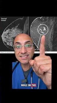 What Does Breast Cancer Look Like? Know the Signs That Matter