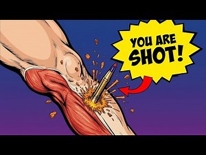 What Does it Actually Feel Like to be Shot?