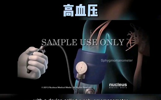 高血压翻译版(中英双字幕)