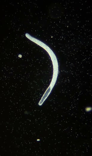 Spirostomum under microscope #science #microscopy