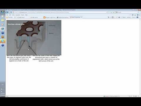 Dermoscopy Made Simple - Introduction
