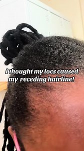 Rebuilding My Hairline After Cutting Off Edges