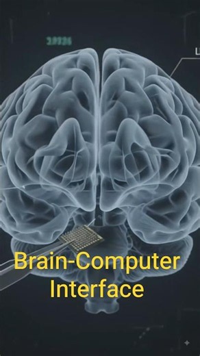 Brain-Computer Interface