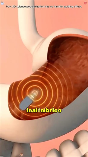 Capsule Endoscopy (3D Animation)#capsule #endoscopy #capsules #endoscopyprocedure #foryoupage