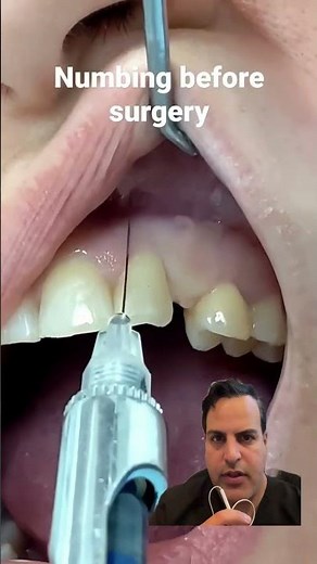 Needle injection into the gums😳#Needle #Dental#Dentist #Dentistry #Shorts #gum