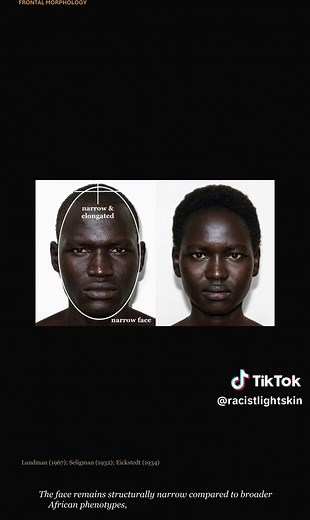The Dinkaid phenotype: an apex of human morphological specialization and evolutionary continuity. Examining the hyper-dolichocephalic cranial architecture, profound cutaneous pigmentation, and long-legged postcranial proportions adapted for severe thermal stress in the Upper Nile. #africantiktok #phenotype #dinka #southsudan #blacktiktok