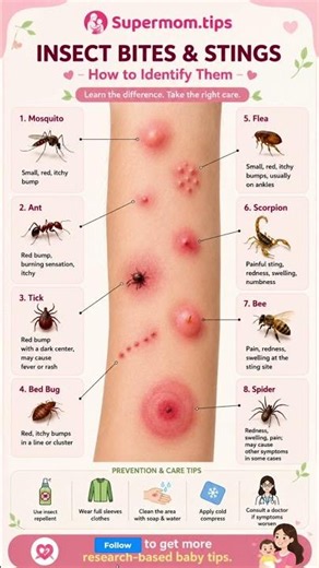 🦟🐜 Not every bite is the same! Learning to identify common insect bites. #babycare #toddlerlife