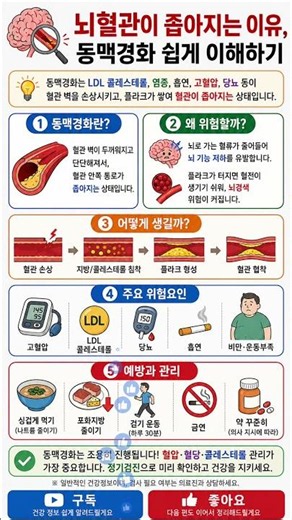 뇌혈관이 좁아지는 진짜 이유, 알고 계셨나요? -동맥경화 쉽게 이해하기-