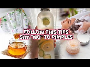 How To Prevent Pimples Naturally | Get Clear Skin With 15 Best Tips🎀💫
