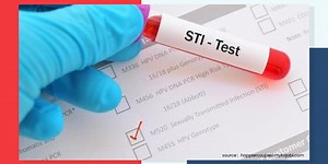 सेक्शुअल बीमारियों की जांच के लिए किए जाते हैं STD Test, जानें क्यों और किसके लिए जरूरी हैं ये टेस्ट