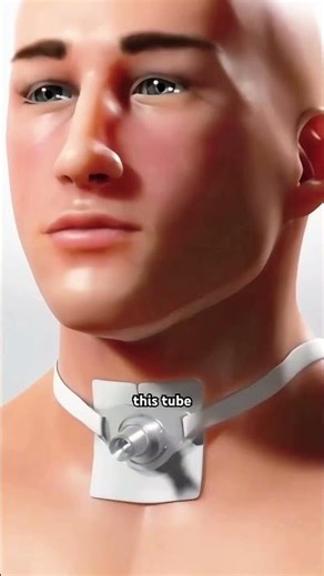 Tracheotomy Procedure!! (3D Animation) #drone #theflash #space #automobile #scifi #humanhand